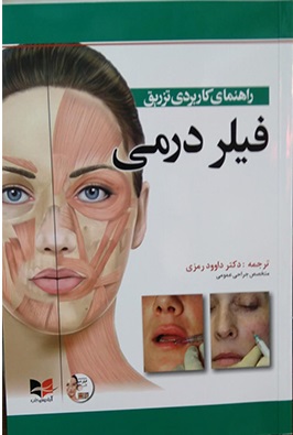 راهنمای کاربردی تزریق فیلر درمی