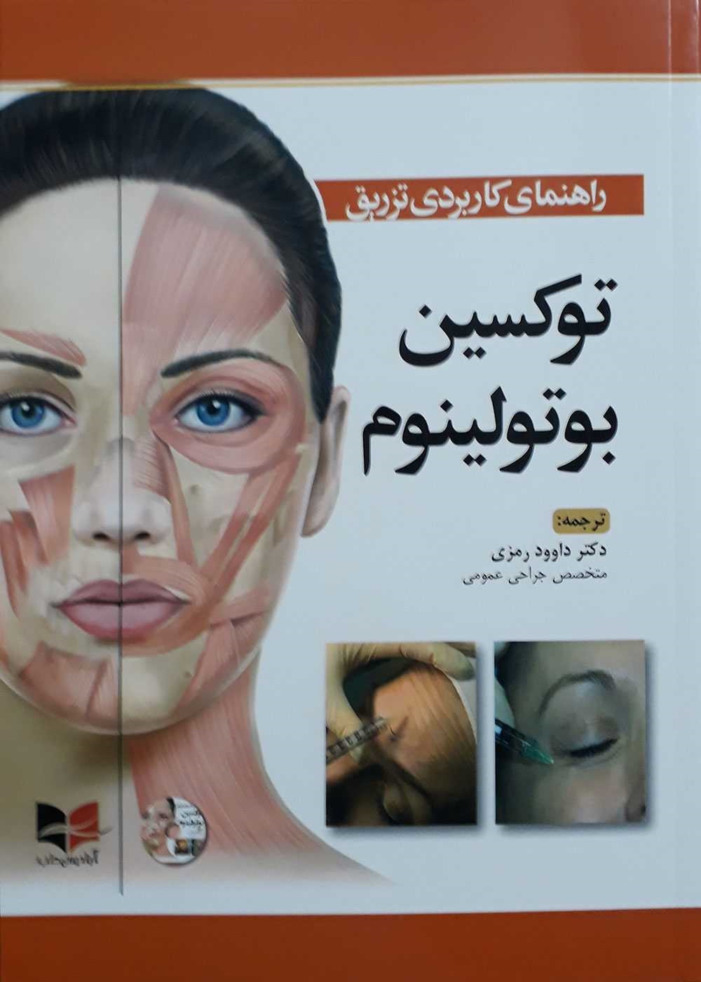 راهنمای کاربردی تزریق توکسین بوتولینوم 