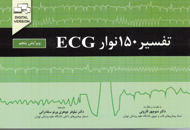 تفسیر 150 نوار ECG