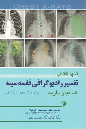 تنها کتاب تفسیر رادیوگرافی قفسه سینه که نیاز دارید