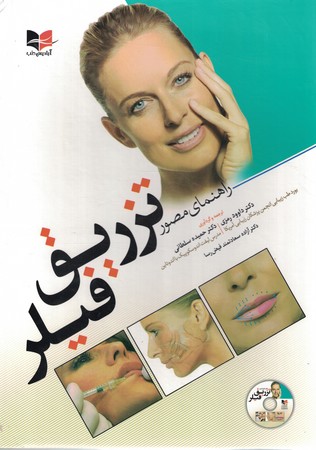 راهنمای مصور تزریق فیلر 