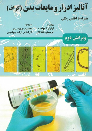 آنالیز ادرار و مایعات بدن (گراف)