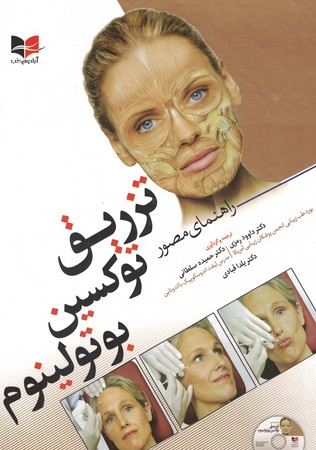 راهنمای مصور تزریق توکسین بوتولینوم