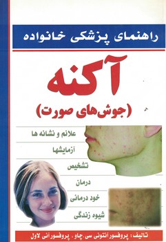 راهنمای پزشکی خانواده آکنه (جوش های صورت)