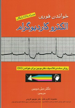 خواندن فوری الکتروکاردیوگرام 