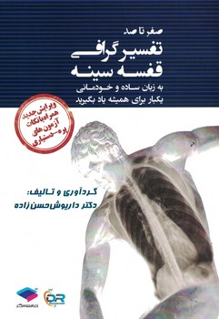 صفر تا صد تفسیر گرافی قفسه سینه (یکبار برای همیشه یاد بگیرید)