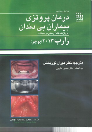درمان پروتزی بیماران بی دندان زارب 2013 (بوچر )