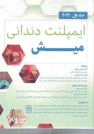 ایمپلنت دندانی میش ۲۰۲۱ جلد اول رنگی