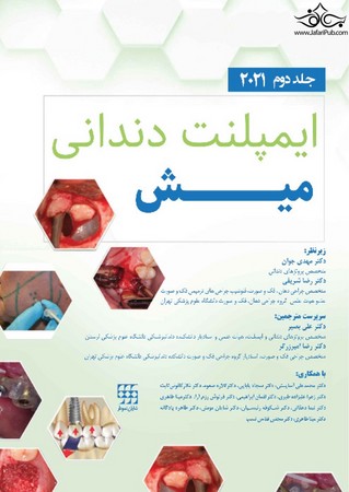 ایمپلنت دندانی میش 2021 جلد دوم ( رنگی)