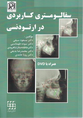 سفالومتری کاربردی در ارتودنسی
