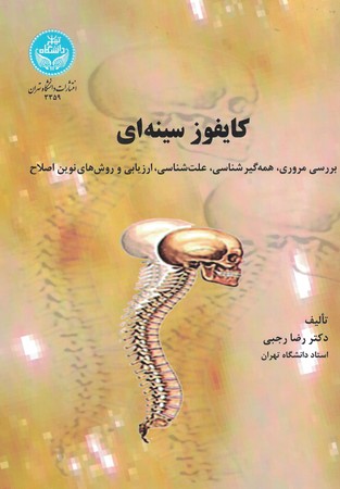 کایفوز سینه ای