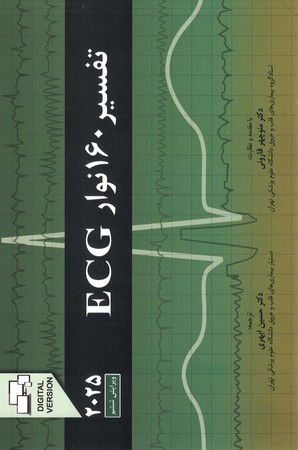 تفسیر 160 نوار ECG