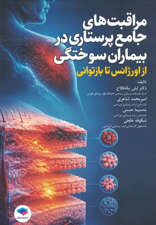 مراقبتهای جامع پرستاری در بیماران سوختگی 