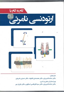 گام به گام با ارتودنسی نامرئی