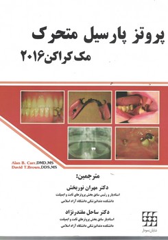 پروتز پارسیل متحرک (مک کراکن 2016)
