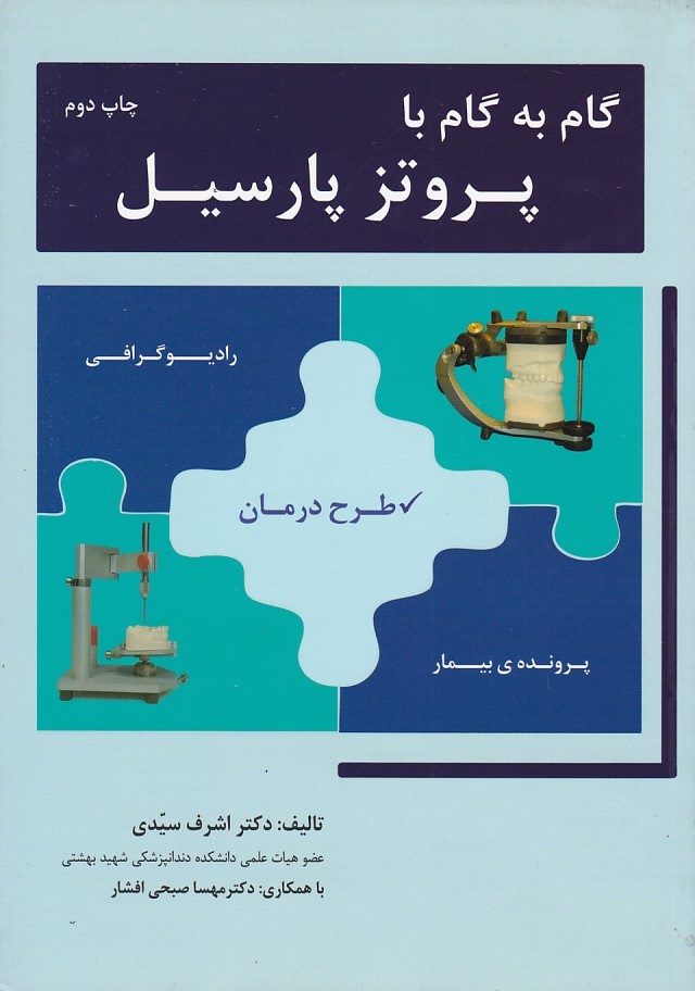 گام به گام پروتز پارسیل 