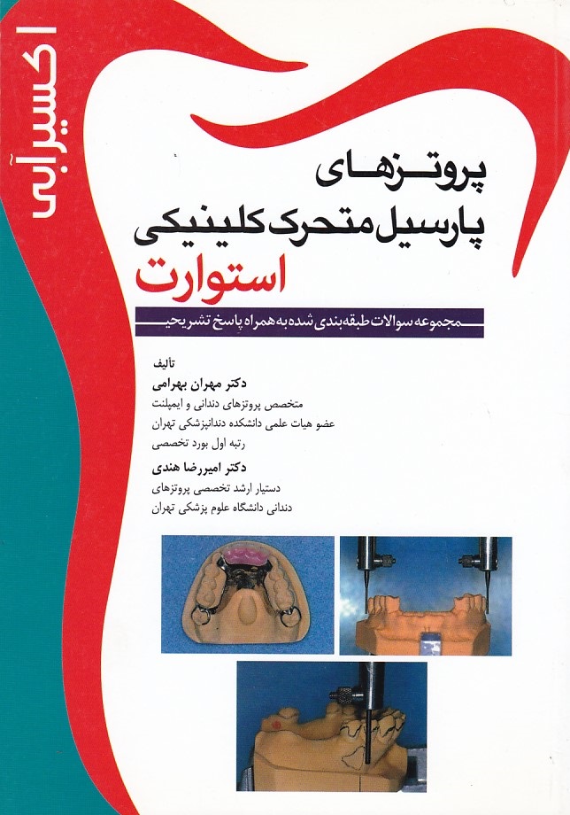 پروتزهای پارسیل متحرک کلینیکی استوارت 