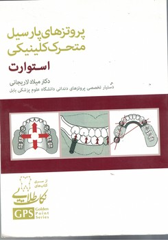 پروتزهای پارسیل متحرک کلینیکی استوارت